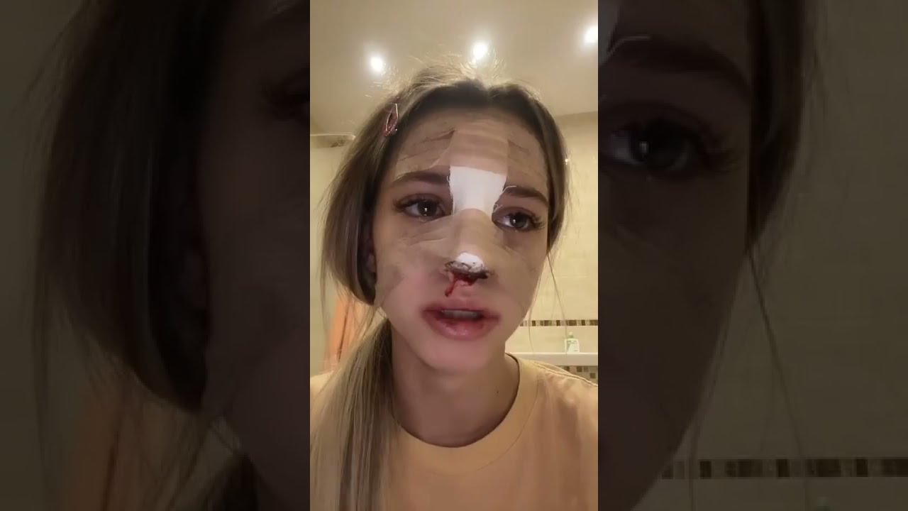 Разбитое лицо фото девушки