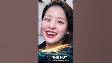 Bọc răng sứ Orodent | Khách Hàng Review #shorts