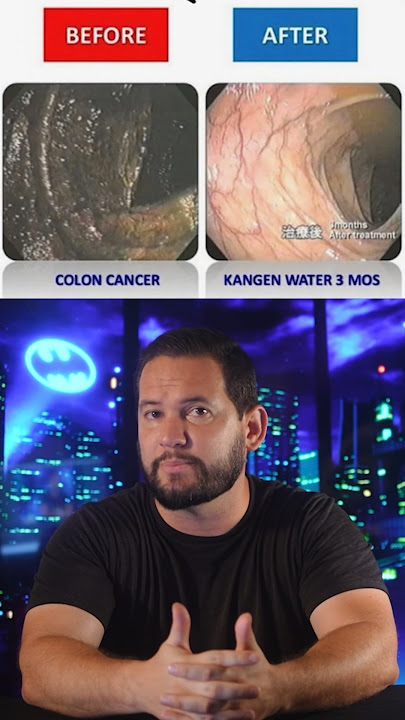 The Kangen Scammers Won’t Stop!