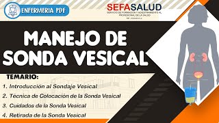 Manejo de Sonda Vesical