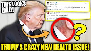 Internet EXPLODES over Trump's CRAZY New HEALTH ISSUE!