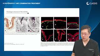 Ultraformer III Classys Neck Treatment Guide by Venn Healthcare Ltd 5,085 views 2 years ago 1 hour, 1 minute