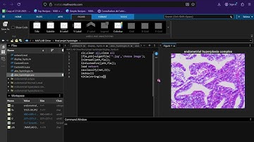 🧠 CNN Transfer Learning in MATLAB | Classification of Endometrial Diseases (Cancer, Polyps & More)