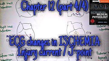 ECG changes in ischemia/infarction -chapter 12 (part 4/4) - Guyton and Hall text book of physiology.