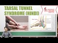 Tarsal Tunnel syndrome (Hindi)