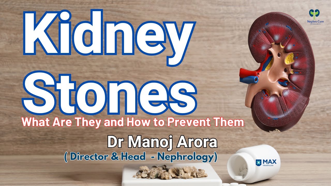 Kidney Stones: Causes, Symptoms & How to Prevent Them - YouTube