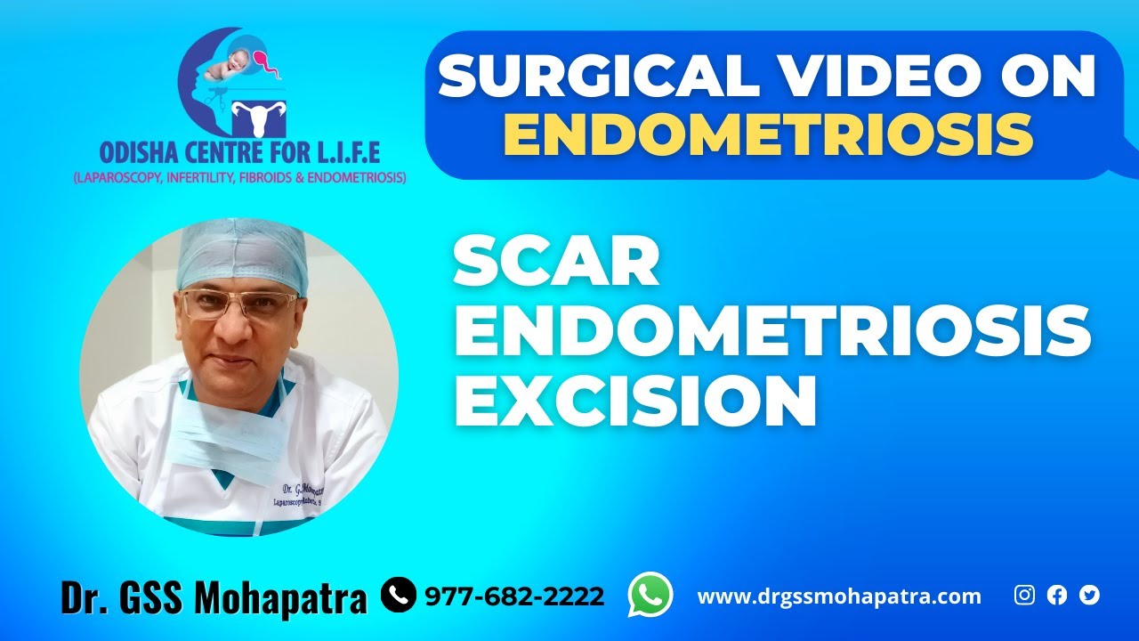 SCAR ENDOMETRIOSIS EXCISION BY ENDOMETRIOSIS SPECIALIST DR G S S