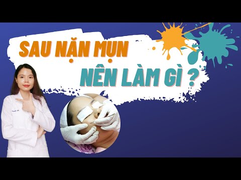 sau khi nặn mụn nên làm gì ?  – Cách chăm sóc da sau khi nặn mụn .