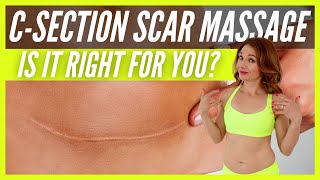 C-Section Scar Massage: Is It Right For You? (THIS IS WHO SHOULD DO C-SECTION SCAR MASSAGE)