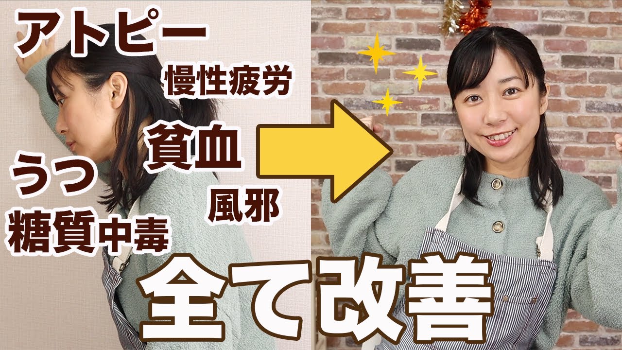 アトピー 肌荒れの方必見 アトピーで私がやめた事 取り入れた事 Youtube アトピー 肌荒れの方必見 アトピーで私がやめた事 取り入れた事 Youtube