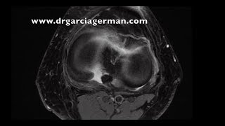 Diego García-Germán Vázquez-15