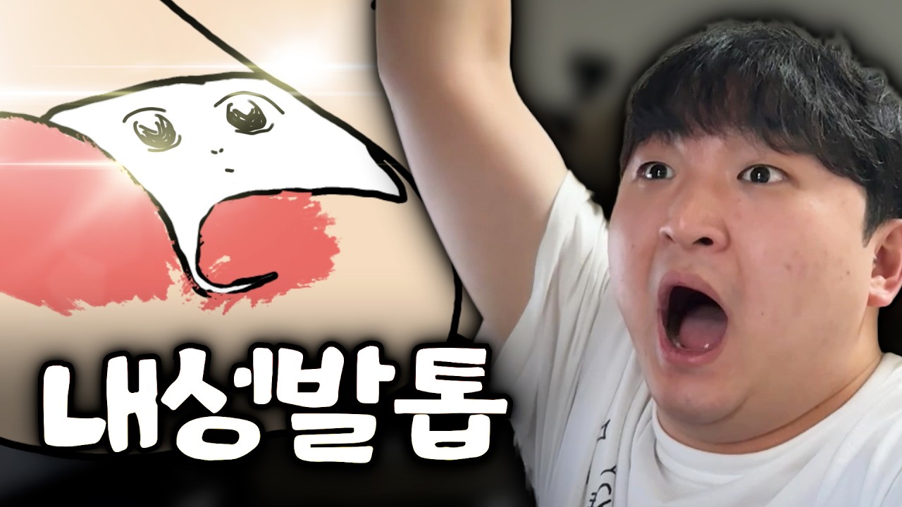 애완 내성발톱 1년간 키우다가 집에서 혼자 뽑아버린 썰