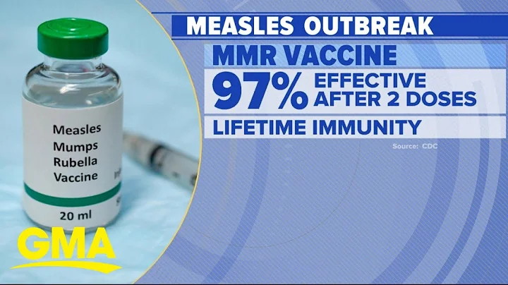 Health officials urge people to check immunization records amid measles outbreak l GMA