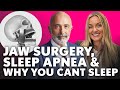 42 jaw surgery transformation dr paul coceancigs cure for snoring  sleep apnea