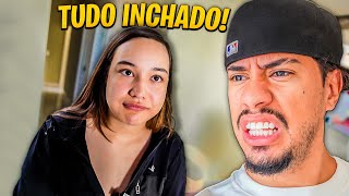 ELA FICOU COM A CARA TODA INCHADA POR CAUSA DA CIRURGIA DE ULTIMA HORA😱