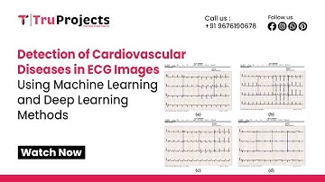 Detection of Cardiovascular Diseases in ECG Images Using Machine Learning and Deep Learning Methods