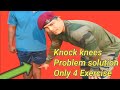Knock knees problem solution exercise ll best 4 workout
