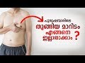 തൂങ്ങിയ മാറിടം എങ്ങനെ ഇല്ലാതാക്കാം? Gynecomastia Treatment Malayalam | Male Breast Reduction|Arogyam