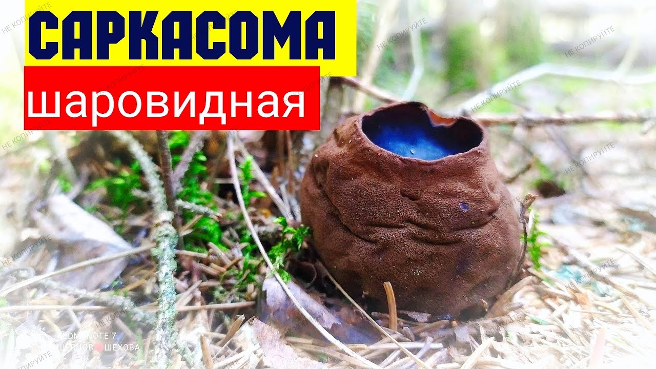 Саркасома шаровидная