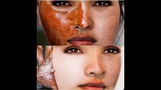 Masque pour éliminer les impuretés et purifier la peau / قناع للتخلص من الشوائب و تصفية البشرة