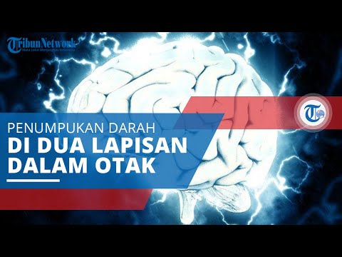 Video: Hematoma Otak: Gejala, Rawatan, Akibatnya
