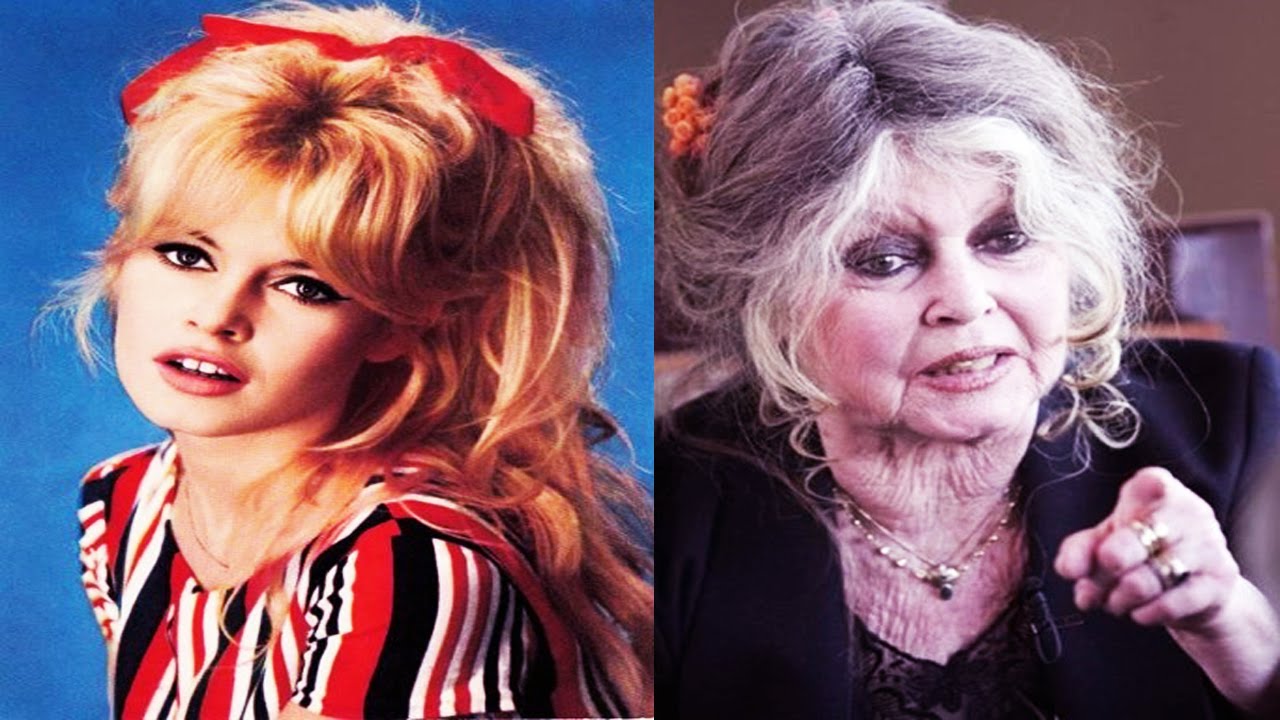 15 celebs who aged badly