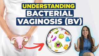 Understanding Bacterial Vaginosis:  A Doctor's Guide to BV and Natural Remedies! screenshot 4