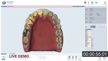 SmartChart™ - 3D Odontogram Demo