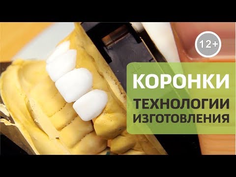 Зубные коронки - что это? | Коронка на зуб - технологии изготовления | Дентал ТВ 12+