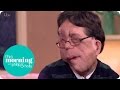 adam pearson talks about judging people by their looks this morning