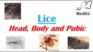 Lice (Head, Body and Pubic Lice) | Pediculosis | Species, Symptoms and Treatment