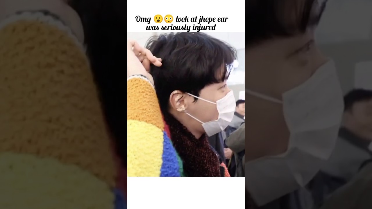 Omg 😟 jhope injured seriously 😳#new update of jhope#shorts #new#kpop#jhope bts#bts