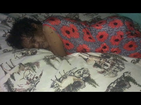 REVISITING LADY LIVING WITH CANCER IN HER MOUTH MS.FERN