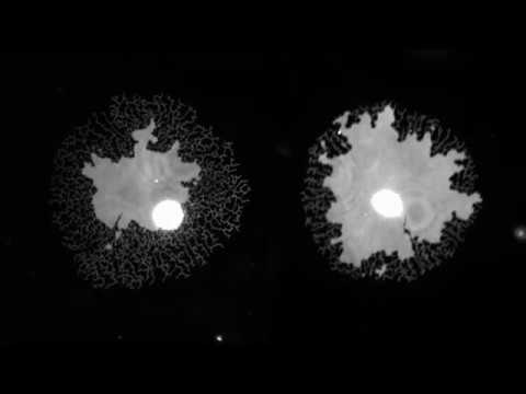 Video: Inddragelse Af Endoplasmatisk Retikulumdannelse Og Proteinsynteseeffektivitet I VCP - Og ATL1-relaterede Neurologiske Lidelser