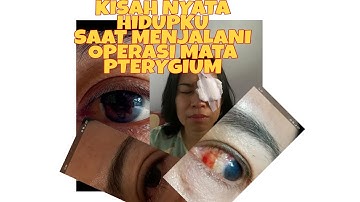 PENGALAMAN HIDUP OPERASI MATA PTERYGIUM