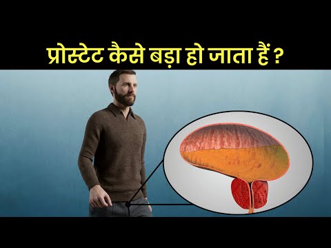 प्रोस्टेट बड़ा कैसे हो जाता है? Benign Prostatic Hyperplasia 