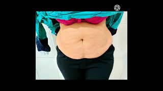 شد ترهلات البطن - ترهلات للرجال  - شد البطن /شفط دهون البطن  / Abdominoplasty  /Tummy tuck