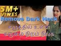 How to get rid of DARK NECK||simple and easy method||100%natural &  effective||tamil youtuber