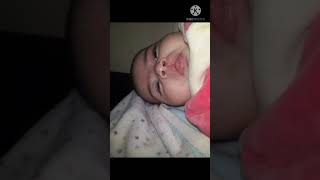 عملية الشفة الارنبية الحنك المشقوق cleft lip and palate ا.د. صابر عبد المقصود استشاري جراحة التجميل