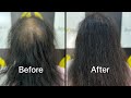 Permenant hair extensions invisible ice gel capsule technique best review chennai karur trending