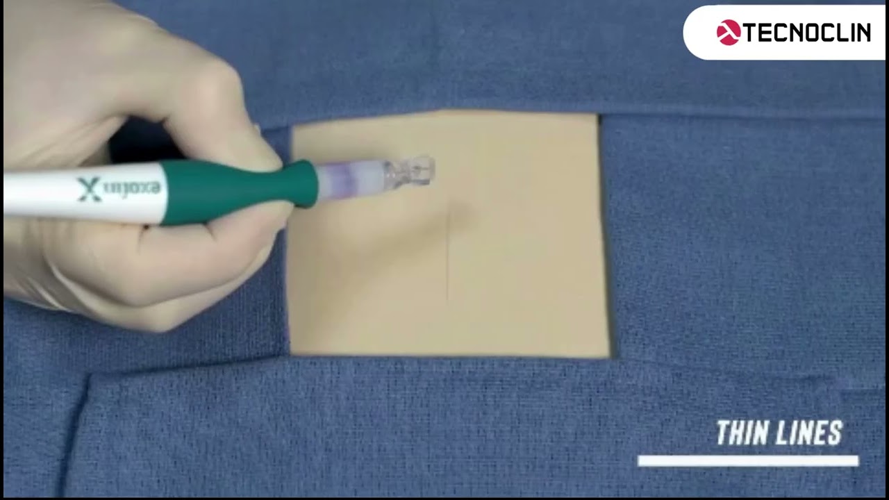 Exofin Precision Pen - Caneta com Cola Cirurgica