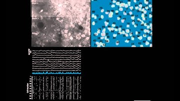 UCLA STEM Microscope - Detail