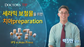 [IPS e.max Press] 세라믹 보철물을 위한 치아preparation