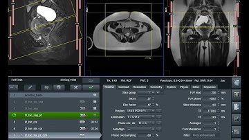 How to MRI of Pelvis | Positioning & Planning Tutorial