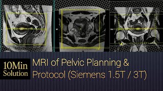 How to MRI of Pelvis | Positioning & Planning Tutorial Profile