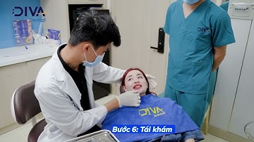 QUY TRÌNH NIỀNG RĂNG TRANSALIGN CỦA KHÁCH HÀNG HỒNG ÁNH - NHA KHOA DIVA