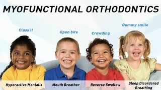 Myofunctional Orthodontics - by MRC (UK)