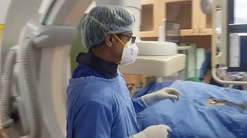 hepatic artery pseudo aneurysm embolization