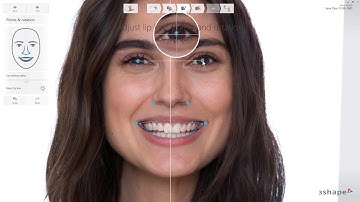 3Shape Smile Design- ново
