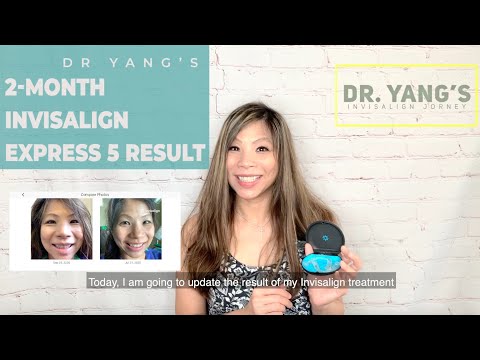 My Invisalign Express 5 Minor Front Teeth Correction Result_ Dr. Yang's Invisalign Journey_ Day59(5)